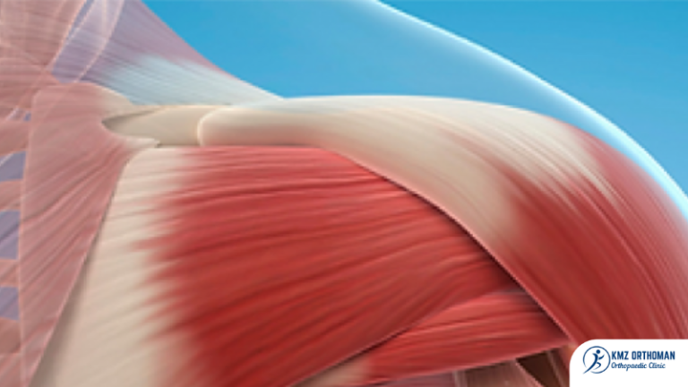 Ketidakstabilan Sendi Bahu “Shoulder Instability” Apakah Itu?