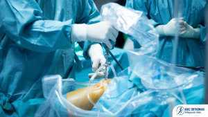 Arthroscopic Surgeries: A Comprehensive Guide by KMZ Orthoman
