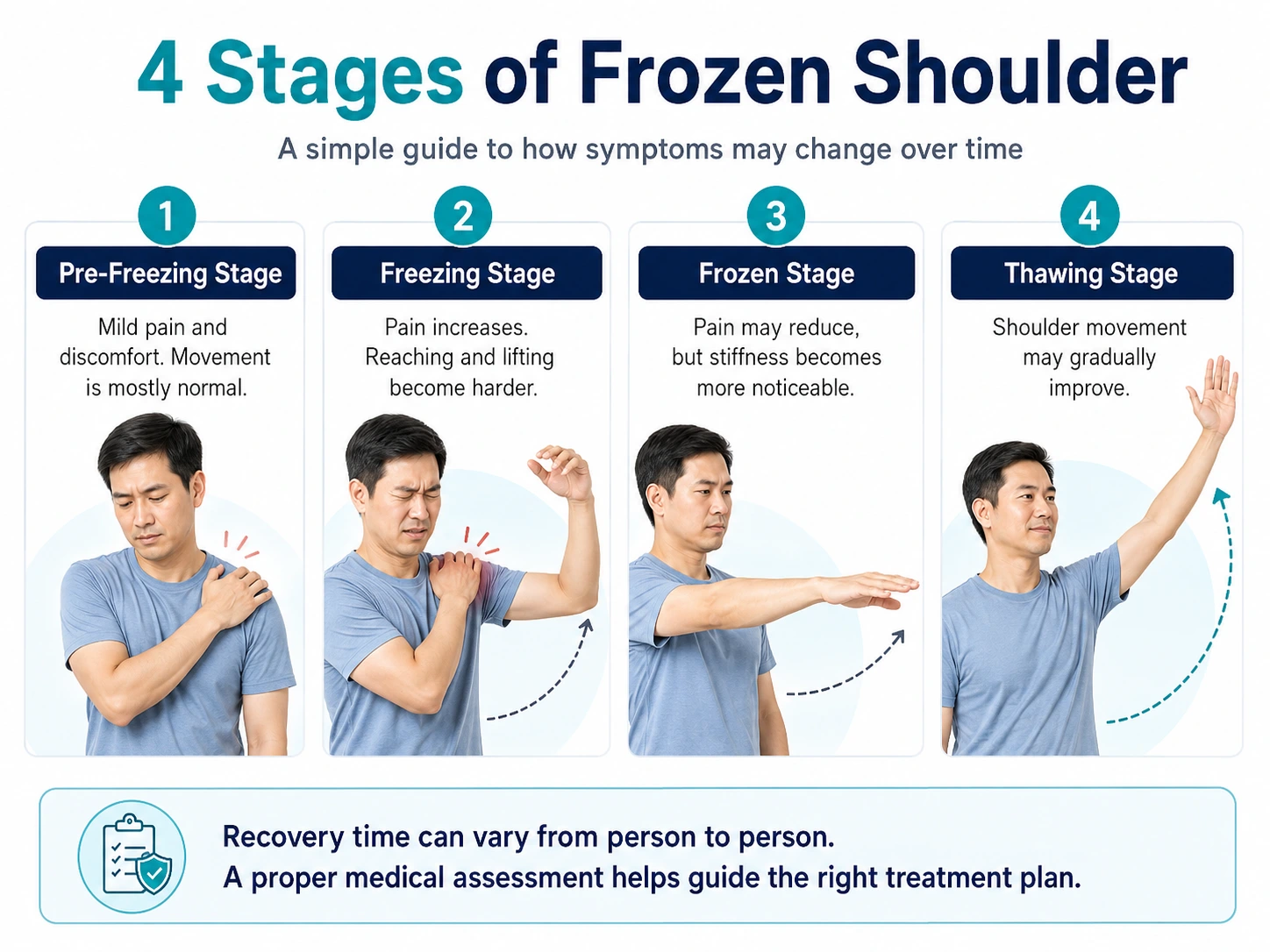 Simple infographic showing the stages of frozen shoulder.