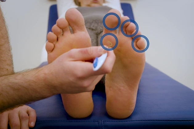 Doctor performing a monofilament sensation test during a diabetic foot assessment in Kuala Lumpur