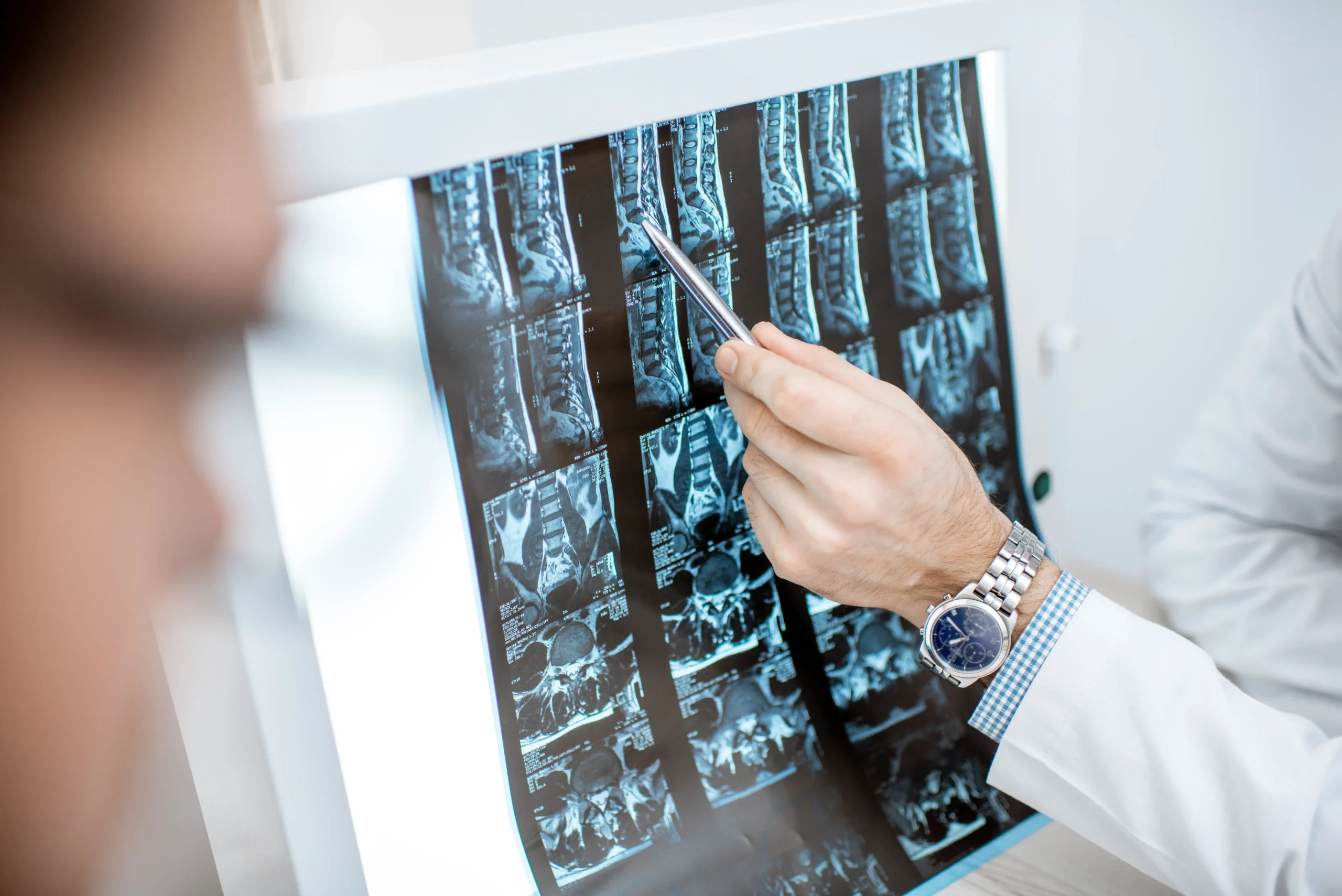 Doctor reviewing a lumbar spine MRI during a back pain assessment in Kuala Lumpur
