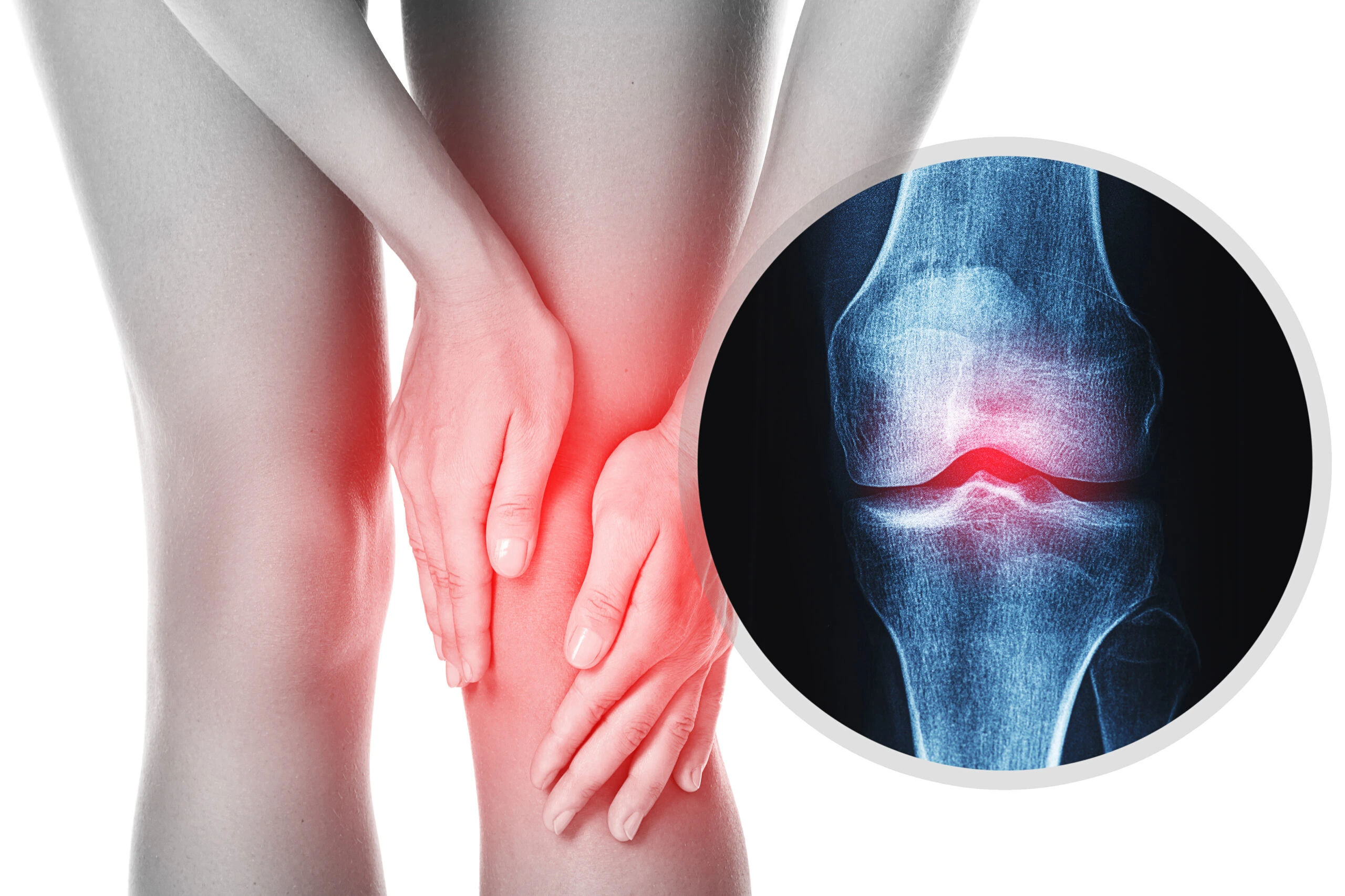 Osteoarthritis assessment and treatment consultation